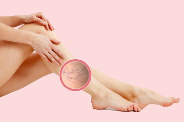 aloe vera y la circulación